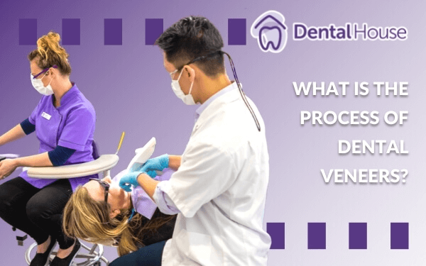 What Is The Process Of Dental Veneers?