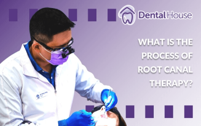 What Is the Process of Root Canal Therapy?