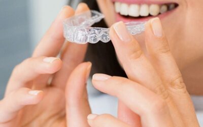 Can Invisalign Fix Overbites and Underbites?