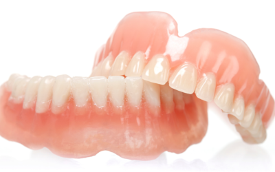 Never Go Without a Smile: How Immediate Dentures Work