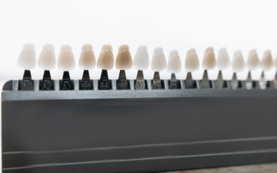 How Long Do Porcelain Veneers Really Last?