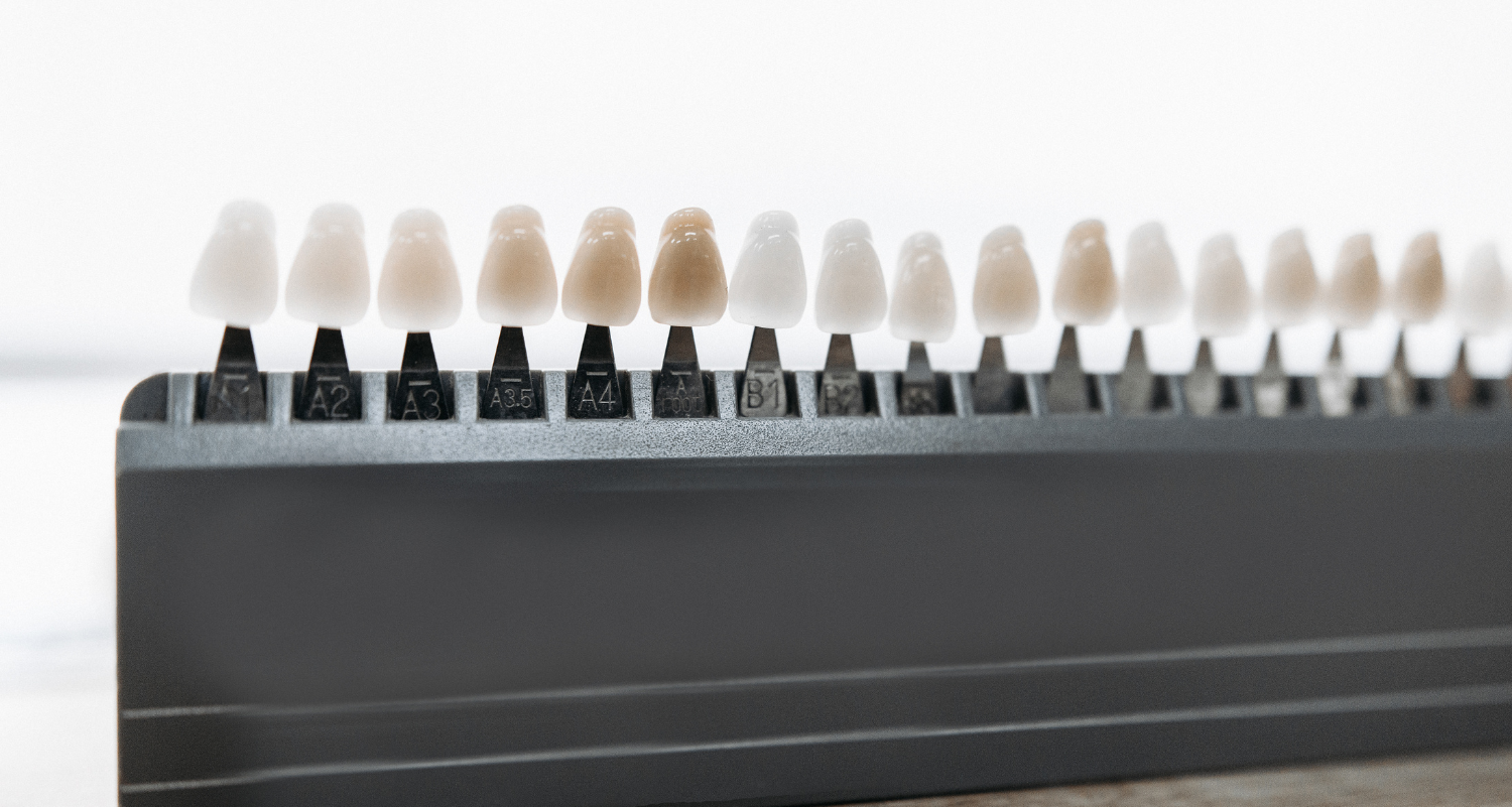 Veneer Lifespan Veneer Lifespan | How Long Do Porcelain Veneers Last? Bacchus Marsh Melbourne