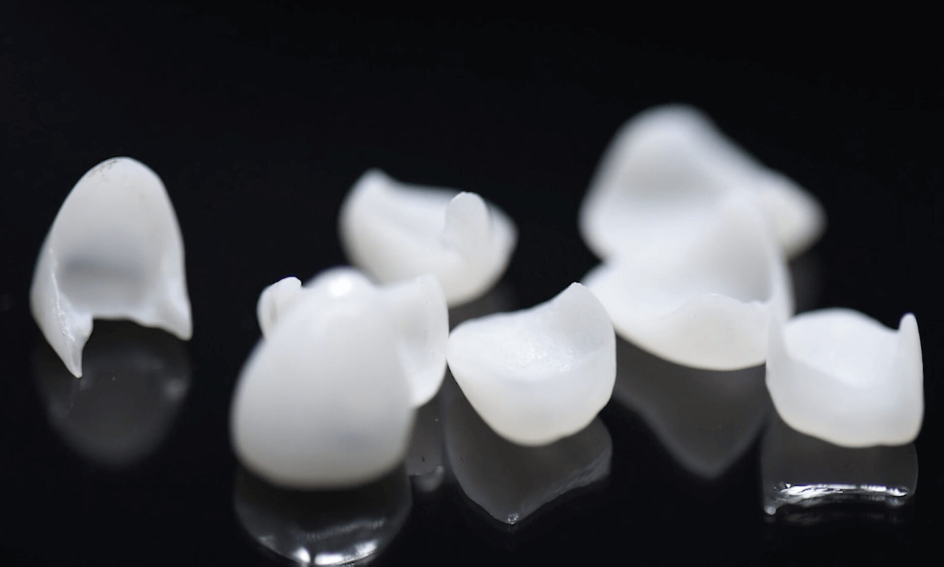 Dental House Group Dental Veneers