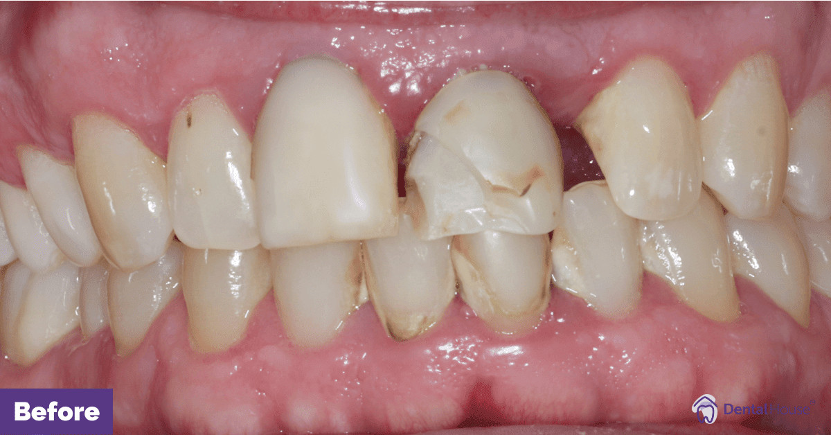 E’s Smile Makeover in Gisborne Gallery image
