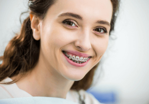 How to Fix Crooked Teeth? How to Fix Crooked Teeth 500x350 1