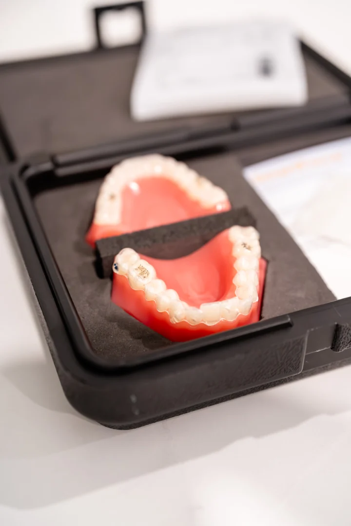 Invisalign and Its Effectiveness Bacchus Marsh