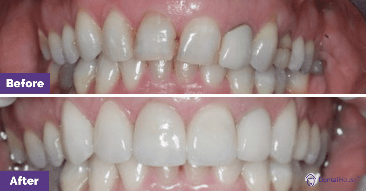 JM’s Porcelain Veneers & Whitening in Gisborne Gallery image