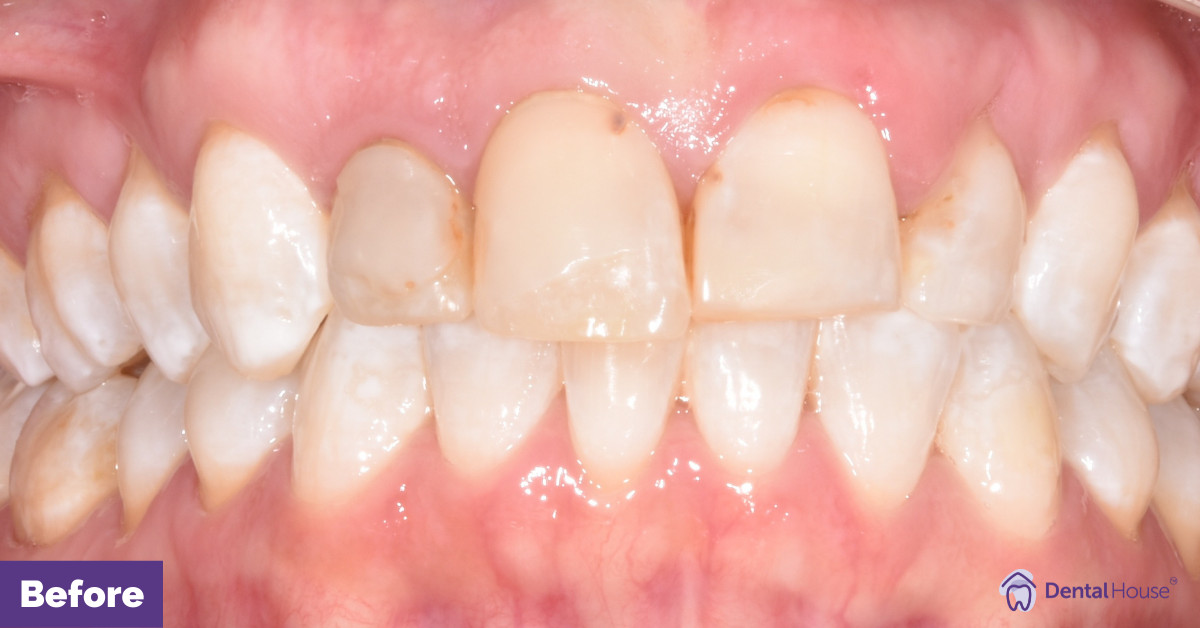 Kerrie’s Smile Make over in Sunbury Gallery image
