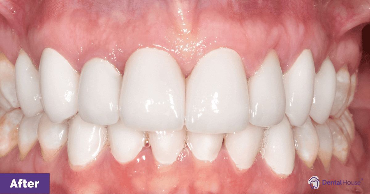 Kerry’s Smile Makeover in Bacchus Marsh Gallery image