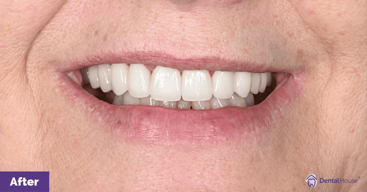 L’s Smile Makeover in Sunbury Gallery image