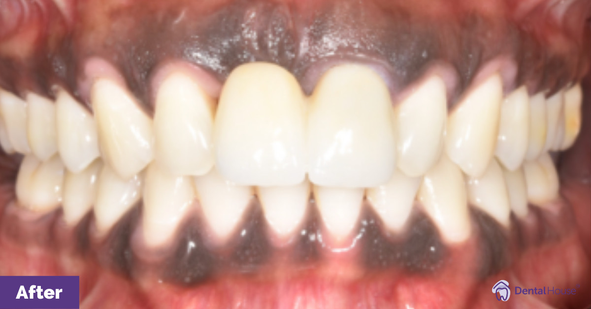 Riak’s Smile Make over in Sunbury Gallery image