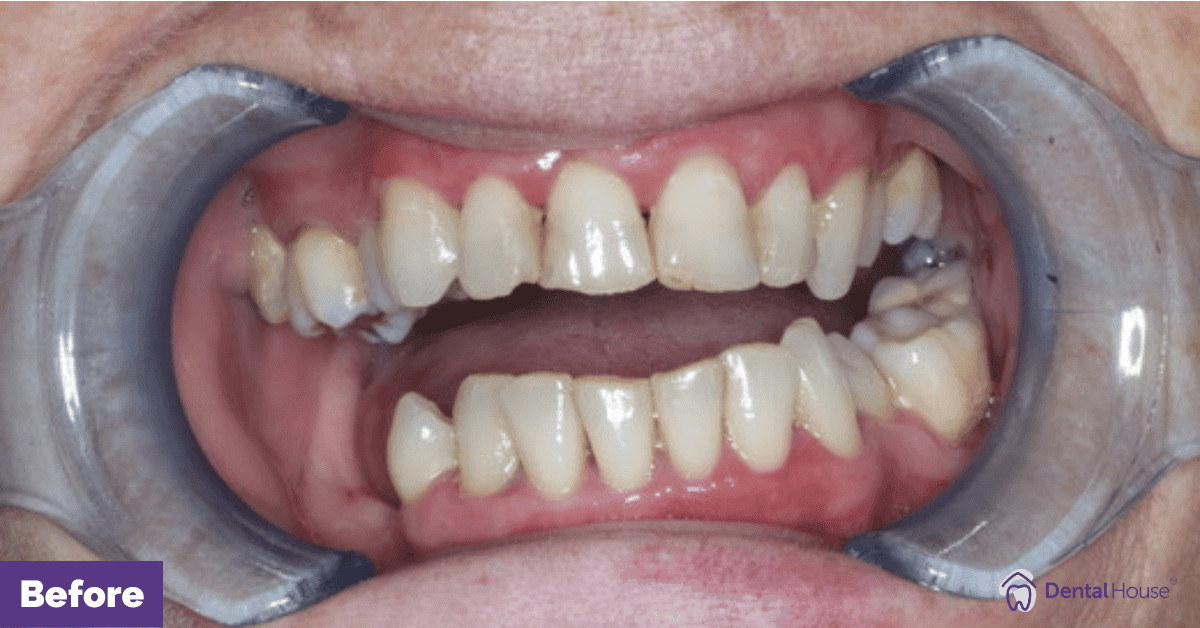 SS’s Porcelain Veneers & Whitening in New Gisborne Gallery image