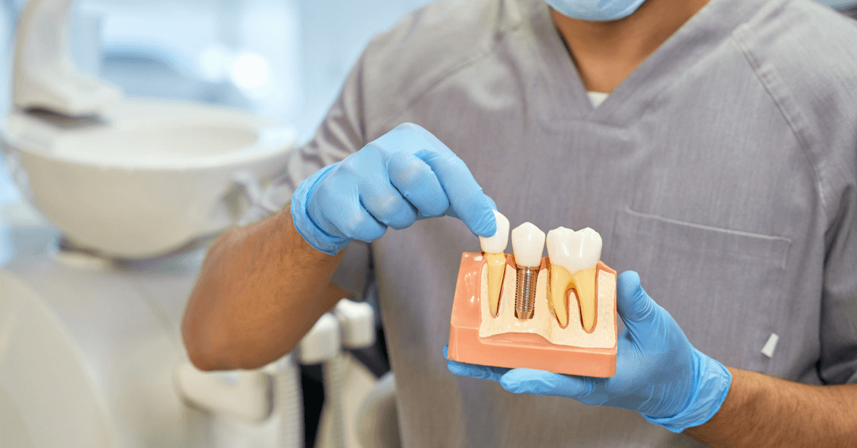 What Is the Warranty of Dental Implants Melbourne Dental House Group