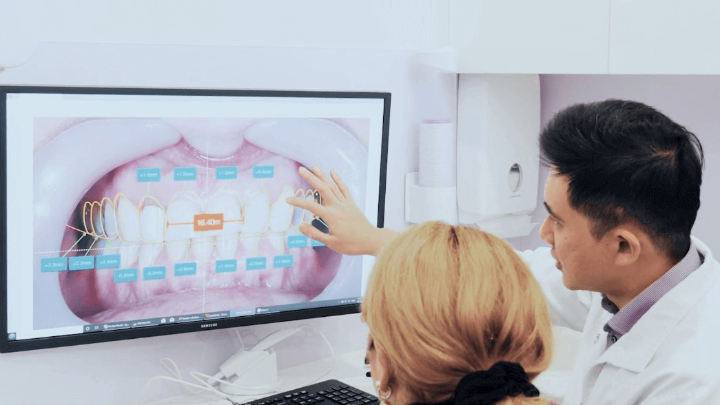 What Is The Process Of Dental Veneers? What is the Process of Dental Veneers Updated